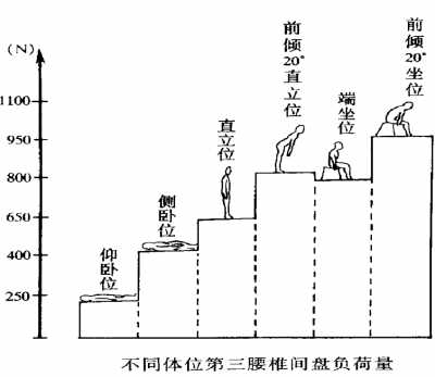 护腰椎要从姿势开始 坐时不要懒散站时倒腿休息