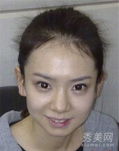 女星素颜差距大:李小璐眼袋浮肿宋祖英皱纹