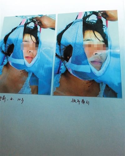 19岁少女死于戒网瘾学校 5人被刑拘