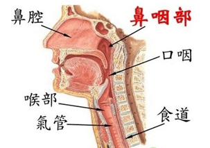 头痛耳鸣或是鼻咽癌 鼻咽癌有哪些典型症状?