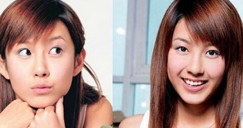 Chenhe divorce unexpectedly because she Jie Zhang Zixuan plastic surgery before and after comparison - 11931959598180914735