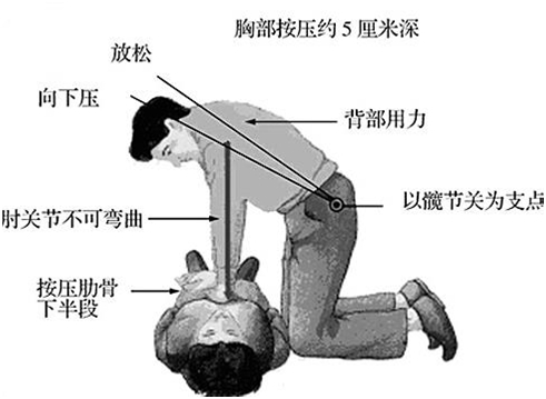 心肺复苏 黄金4分钟 半数患者可能被救活