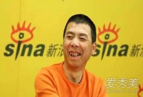 被一口烂牙毁容的10大明星