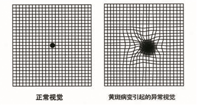 最近网上疯传的"a4纸人生表格 还可以测眼底病