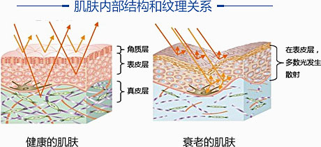 变化2:肌肤纹理明显少女肌肤纹理细致,近看就像是高级的细纱网,排列