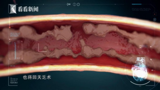 人口定时炸弹(2)